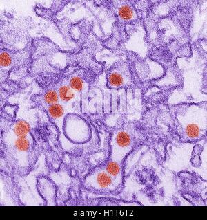 Zika virus. Colorato micrografia elettronica a trasmissione (TEM). Foto Stock