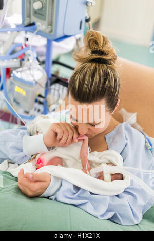 Prematuro neonato posto sotto assistenza respiratoria, Dipartimento di Pediatria, ospedale di Bordeaux, Francia. Foto Stock