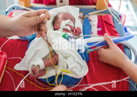 Prematuro neonato posto sotto assistenza respiratoria, Dipartimento di Pediatria, ospedale di Bordeaux, Francia. Foto Stock