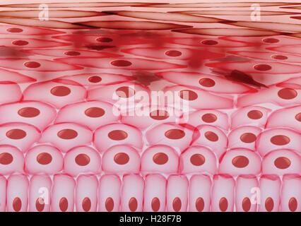 Le cellule della pelle, eczema, infiammato gli strati di pelle Illustrazione Vettoriale