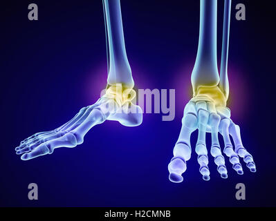 Piede dello scheletro - injuryd osso astragalico. Vista a raggi x. Accurata dal punto di vista medico 3D illustrazione Foto Stock