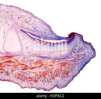 Il fingertip. Micrografia di luce (LM) di una sezione attraverso il fingertip. Il chiodo (arancione) è al centro superiore, con la radice delle unghie di seguito. Il letto ungueale è viola scuro ed è continuo con l'epitelio. La punta del dito di osso rosa pallido(centro sinistra). Al di sotto del epitelio squamoso stratificato è il derma, che contiene tessuto adiposo (FAT) cellule del tessuto connettivo e vasi sanguigni. Ingrandimento: x5 quando stampata a 10 cm di larghezza. Foto Stock
