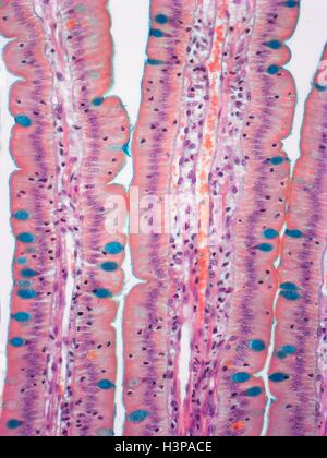 Il piccolo intestino. Micrografia di luce (LM) di una sezione attraverso le dita (villi) del duodeno, la parte più alta del piccolo intestino. Questi aumentano la superficie di assorbimento del cibo. Nell'epitelio colonnare della superficie esterna (rosa) sono cellule caliciformi (colorato in blu con colorazione speciale), che secernono muco per lubrificare il cibo e prevenire l'auto-digestione. La lamina propria (nucleo centrale, ) contiene il rifornimento di sangue che trasporta i prodotti della digestione. Ingrandimento: x350 quando stampata a 10 cm di larghezza. Foto Stock