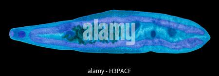 Fegato Fluke. Micrografia di luce (LM) di fegato fluke Clonorchis sinensis, che infetta milioni di persone in Estremo Oriente. Foto Stock