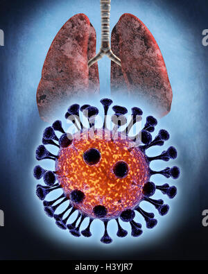 La composizione, coronavirus SARS cause, polmone, medicina, malattie infettive, malattie infettive, malattie, malattia, virus, coronavirus, coronavirus SARS virus patogeno, pericolo, causa, SARS, la sindrome respiratoria acuta severa, Severe Acute Respiratory syndro Foto Stock