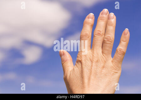 Le mani della donna di mezza età deformata da artrite Foto Stock