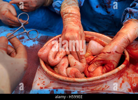 La simulazione di una operazione chirurgica con un film e tv falsa fatta dal make-up e protesi esperto Max Campbell come un insegnamento ai Foto Stock