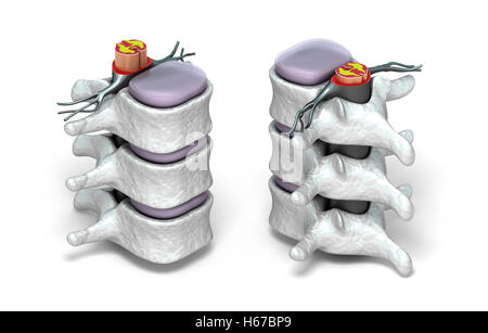 Colonna vertebrale umana nei dettagli: Vertebra, midollo osseo, disco e nervi. Isolato su bianco immagine 3D. Foto Stock