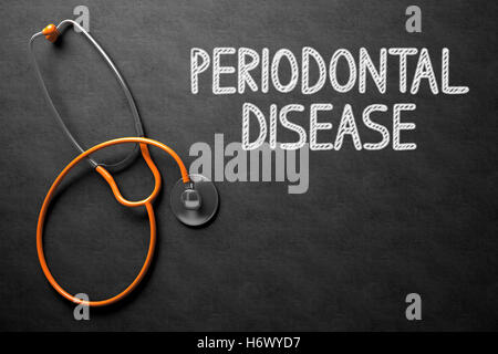 Lavagna con la malattia periodontale. 3D'illustrazione. Foto Stock