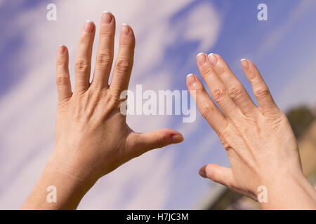 Le mani della donna di mezza età deformata da artrite Foto Stock