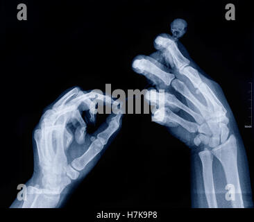 I raggi x immagine di braccia umane tenendo creatura sconosciuta Foto Stock