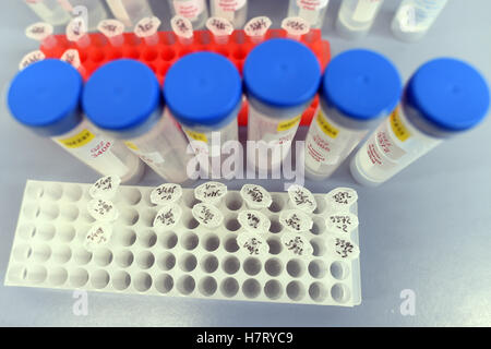 Duesseldorf, Germania. 08 Nov, 2016. Campioni su una tabella a Duesseldorf in Germania, 08 novembre 2016. Lo stato dell'Agenzia ambientale del Land Renania settentrionale-Vestfalia ha svelato un laboratorio speciale appositamente creato per lo studio della Legionella. La nuova struttura di ricerca è la prima appartenente allo stato progettato per l'esame dei batteri pericolosi. Foto: Federico Gambarini/dpa/Alamy Live News Foto Stock