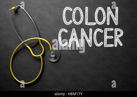 Lavagna con il cancro al colon. 3D'illustrazione. Foto Stock