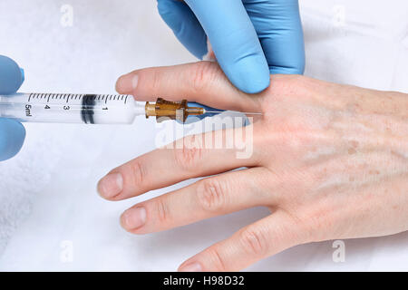 Anti-età terapia di iniezione. Ringiovanimento a mano Foto Stock