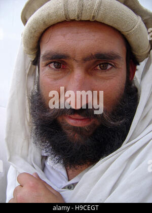 31 Maggio 2004 - Ritratto di un Pashtun uomo dentro il Wazir Akbar Khan centro ortopedico nel nord di Kabul, Afghanistan. Foto Stock