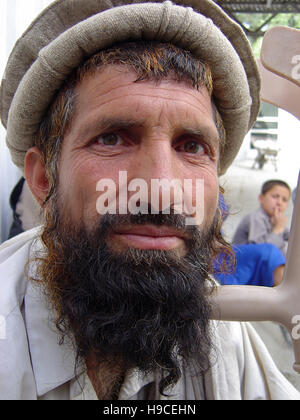 31 Maggio 2004 - Ritratto di un Pashtun tribesman dentro il Wazir Akbar Khan centro ortopedico nel nord di Kabul, Afghanistan. Foto Stock