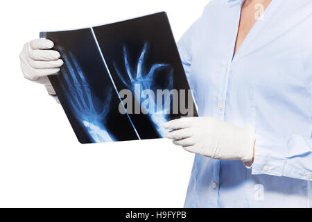 Chiudere sparare la mano e le dita xray nelle mani di medico Foto Stock