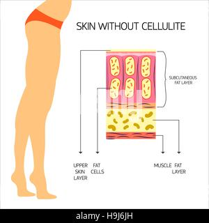 Cellulite illustrazione vettoriale Illustrazione Vettoriale