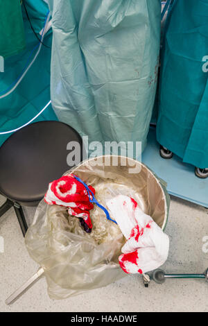 Il sangue su spugne chirurgiche. Sostituzione di valvola cardiaca chirurgia, sala operatoria, Reykjavik, Islanda. Foto Stock