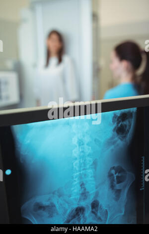 Close-up di x-ray monitor Foto Stock