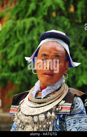 L'interessante le donne di Matang Gejia Dong Village di Guizhou della Cina radere la loro fronte come parte della loro cultura. Foto Stock