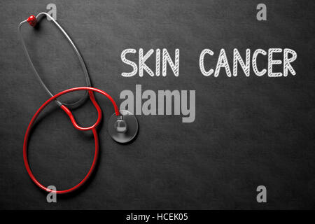 Lavagna con il cancro della pelle del concetto. 3D'illustrazione. Foto Stock