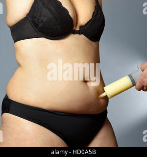 Corpo di un Rotund Woman in reggiseno e pantaloni con un maschio di mano che tiene una siringa con grasso aspirata al di fuori del suo ventre, liposuzione Foto Stock