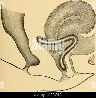 Malattie delle donne. Una guida clinica per la loro diagnosi e trattamento (1899) Foto Stock