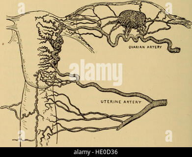 Malattie delle donne. Una guida clinica per la loro diagnosi e trattamento (1899) Foto Stock