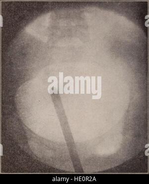 Le 1910 transazioni dell'American Association of Obstetricians and Gynecologists, che documentano i risultati dell'anno, le pratiche mediche e i progressi in ostetricia e ginecologia. Foto Stock