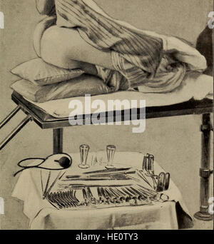 Asettico tecnica chirurgica- con particolare riferimento alla gynC3A6cological operazioni (1902) Foto Stock