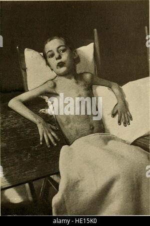 Un testo medico del 1910 che descrive le malattie cardiache e arteriose, progettato come guida pratica per studenti e professionisti del settore medico, che offre approfondimenti sulla diagnosi, il trattamento e la prevenzione delle condizioni cardiovascolari. Foto Stock