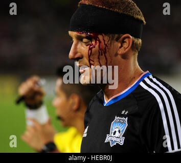 Il sangue fluisce dalla testa di San Jose di terremoti in avanti Shane Lenhart dopo una collisione in volo con una galassia di Los Angeles player nella seconda metà del concorso di MLS a Palo Alto, in California, il 29 giugno 2013. Lenhart fu costretto a lasciare il gioco a causa del pregiudizio. (U.S. Air Force foto di Airman 1. Classe Bobby Cummings/rilasciato) Foto Stock