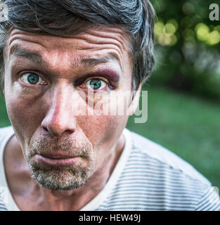 Ritratto di uomo con occhio nero guardando la fotocamera faccia di trazione Foto Stock