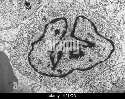 L'immagine del microscopio elettronico a trasmissione mostra la linea cellulare AML-M5B differenziata in promonociti, utilizzata per la ricerca ematologica e gli studi cellulari. Foto Stock