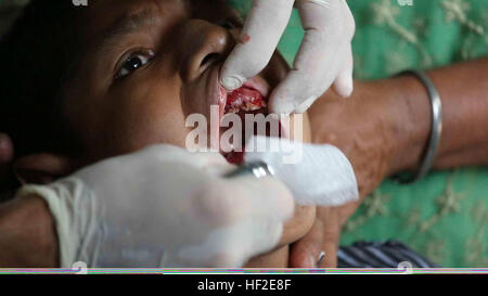 Un bambino riceve cure dentarie presso una scuola in Izabal dipartimento di Guatemala il Agosto 23, 2014, durante il Sud Stazione di partenariato (SPS) 2014. I militari USA il personale medico, Ministero guatemalteco di sanità pubblica e di assistenza sociale e di rappresentanti del personale medico con il Guatemala Brigata Marino fornite cure mediche ai residenti area durante l'evento. SPS è una distribuzione annuale delle navi degli Stati Uniti per gli Stati Uniti Comando Sud e l'area di responsabilità nei Caraibi e America Latina. L'esercizio prevede la condivisione di informazioni con marine, le guardie costiere e servizi civili in tutta th Foto Stock