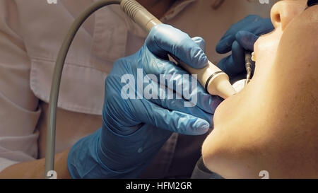 Donna dente ad ultrasuoni odontolith placca rimozione Foto Stock
