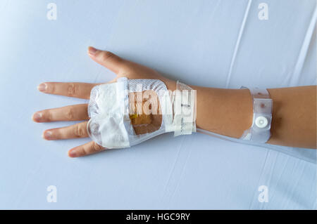 Soluzione salina per via intravenosa (IV) ago inserito in una mano childs fissato con medicazione trasparente. Foto Stock