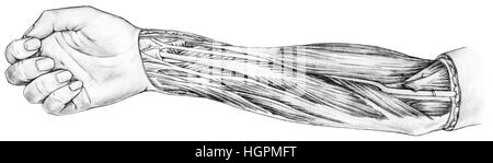 Sono mostrate le mediale intermuscular brachiale setto mediale, epicondyle brachialis muscolo, pronator teres muscolo flessore radiale del carpo il muscolo, palmari Foto Stock