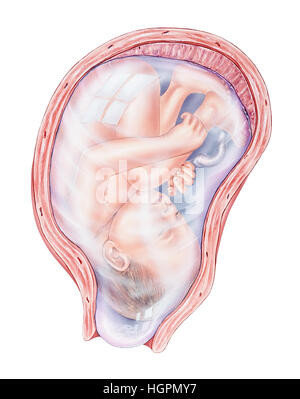 Mostrate sono il feto e la placenta (nella parte superiore dell'utero),  cordone ombelicale, utero, il rigonfiamento del sacco amniotico e la  dilatazione della cervice. Il grado Foto stock