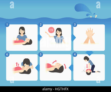 Illustrazione che rappresentano fasi di rianimazione cardiopolmonare Foto Stock