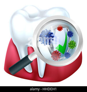 Dente e gomma essendo protetto da batteri da una protezione osservata attraverso una lente di ingrandimento medical dental illustrazione di un Foto Stock