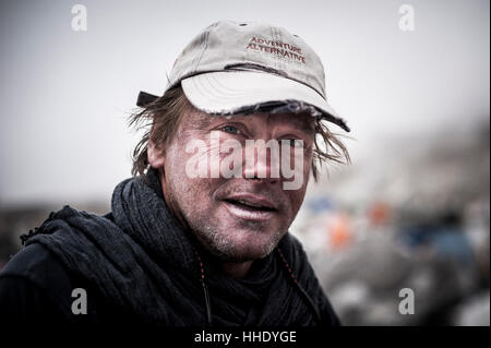 Un scalatore al Campo Base Everest mostra segni di esposizione ad alta altitudine, Regione di Khumbu, in Nepal Foto Stock