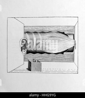 Immagine e testo da "Les malheurs des immortels' (sventure dei immortali), 1922 disegnato da Max Ernst 1891-1976, scritto da Paul Éluard 1895-1952. Cross-Pollination surrealista di immagine e di testo. Foto Stock