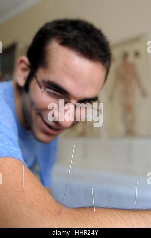 (170120) -- Pechino, 20 gennaio, 2017 (Xinhua) -- Bryan Anker, uno studente dell'Università di California specializazione in studi di globalizzazione, esperienze di agopuntura cinese trattamento a Shuita Street Comunità Heath Service Center di Linfen, nel nord della Cina di nella provincia di Shanxi, Agosto 17, 2012. Il presidente cinese Xi Jinping ha presentato un bronzo statua di agopuntura a gennaio 18, 2017 l'Organizzazione mondiale della sanità (OMS) a Ginevra, Svizzera, che mostra i punti di agopuntura sul corpo umano. Secondo l OMS, 103 deputati hanno dato l'approvazione per la pratica dell'agopuntura e la moxibustione, con 29 avente en Foto Stock