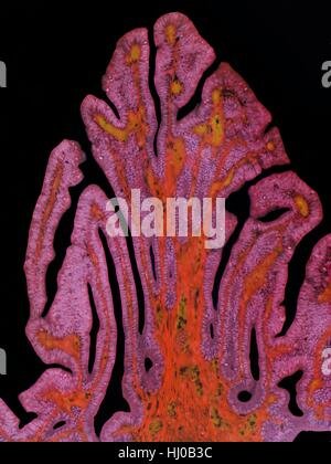 Tubo di Falloppio. Micrografia di luce (LM) di una sezione attraverso un tubo di falloppio, o ovidotto. Le tube di falloppio collegare le ovaie in utero. Il lume è visibile nella parte superiore rivestita con una mucosa (rosa) che contiene ciliate epitelio colonnare e delle cellule di secrezione. A sostegno di questa è una strato vascolare con capillari e uno strato di muscolo liscio (rosso). Ingrandimento: x15 quando stampata a 10 cm di larghezza. Foto Stock