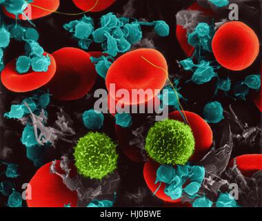 I globuli rossi umani,due dei linfociti T piastrine,composite color scanning electron microfotografia (SEM).le cellule rosse del sangue (RBC),o,gli eritrociti sono la maggior parte del tipo comune delle cellule di sangue nei vertebrati.Essi sono coinvolti nella fornitura di ossigeno ai tessuti del corpo.i linfociti (leucociti,le cellule bianche del sangue) sono Foto Stock