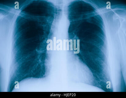 Donna, controllare, salute, macro close-up, macro di ammissione, vista ravvicinata, femmina, Foto Stock