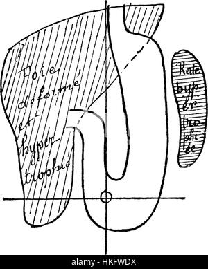 Questa immagine tratta da un antico libro di illustrazione medica, intitolato "EstomacCorset page058", raffigura un disegno anatomico dettagliato di un corsetto. Il lavoro unisce l'illustrazione medica con il design della moda, offrendo uno sguardo sull'intersezione tra moda e salute. Foto Stock
