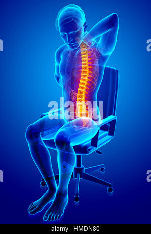 3D illustrazione dei maschi di sensazione di dolore alla schiena Foto Stock